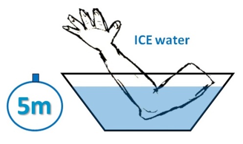 ice bath elbow